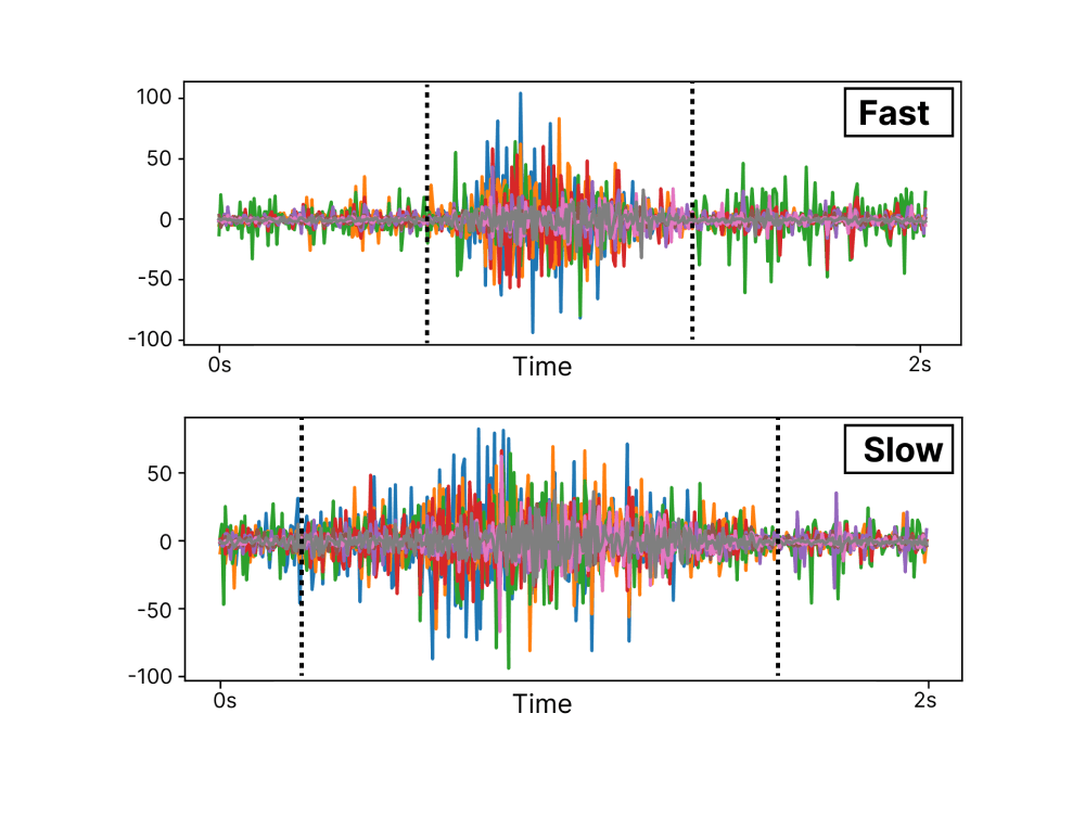 Journal of Neural Engineering