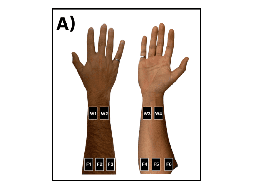 Journal of Neural Engineering